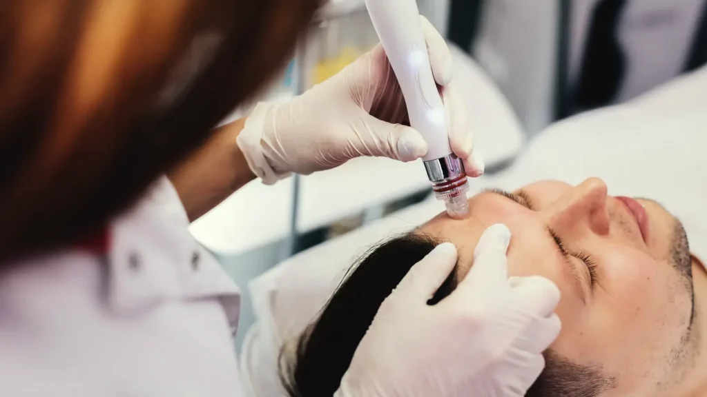Gesichtsbehandlung bei einem Mann mit dem AQAFACIAL™-Handstück an der Stirn, Kosmetikerin mit Handschuhen